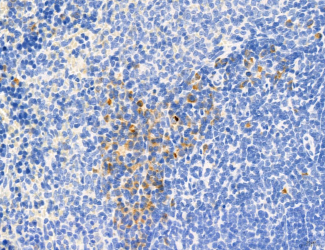 Phospho-MYL2 (Ser15) Antibody in Immunohistochemistry (Paraffin) (IHC (P))