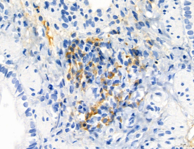 Phospho-MYL2 (Ser15) Antibody in Immunohistochemistry (Paraffin) (IHC (P))