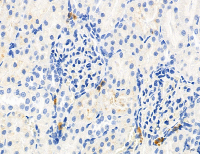 Phospho-MYL2 (Ser15) Antibody in Immunohistochemistry (Paraffin) (IHC (P))