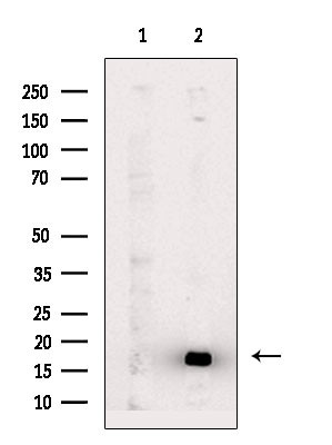 Phospho-MYL2 (Ser15) Antibody in Western Blot (WB)