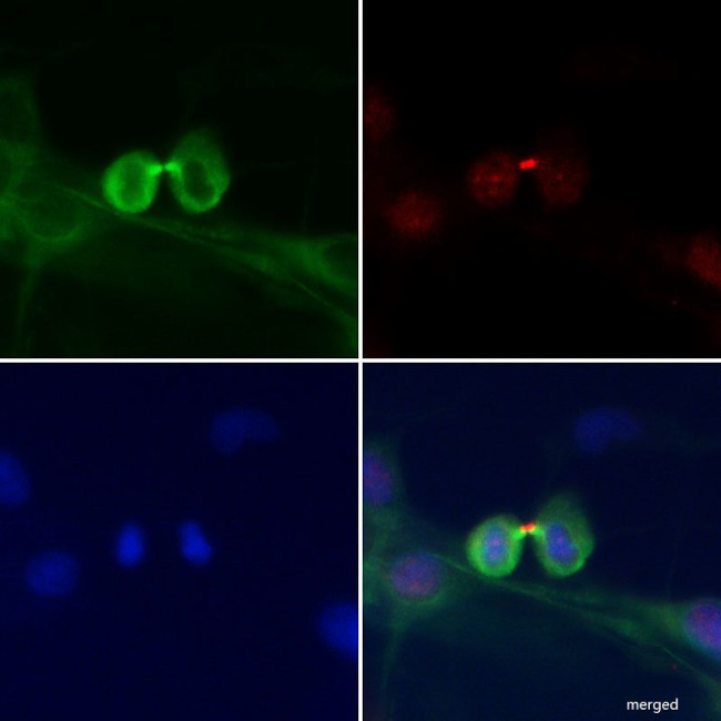 Phospho-MYL2 (Ser15) Antibody in Immunocytochemistry (ICC/IF)