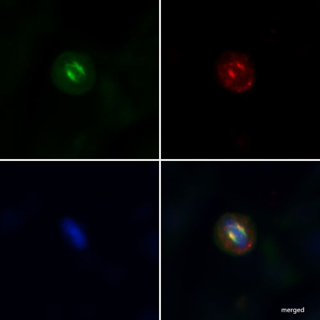 Phospho-MYL2 (Ser15) Antibody in Immunocytochemistry (ICC/IF)