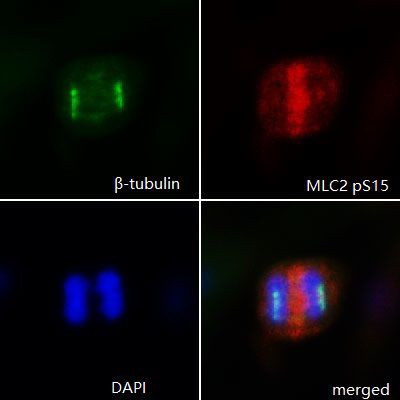 Phospho-MYL2 (Ser15) Antibody in Immunocytochemistry (ICC/IF)