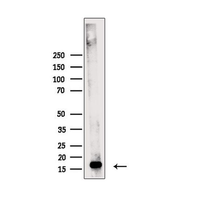 Phospho-MYL2 (Ser15) Antibody in Western Blot (WB)