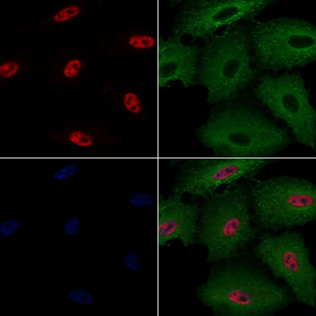 ASF1B Antibody in Immunocytochemistry (ICC/IF)