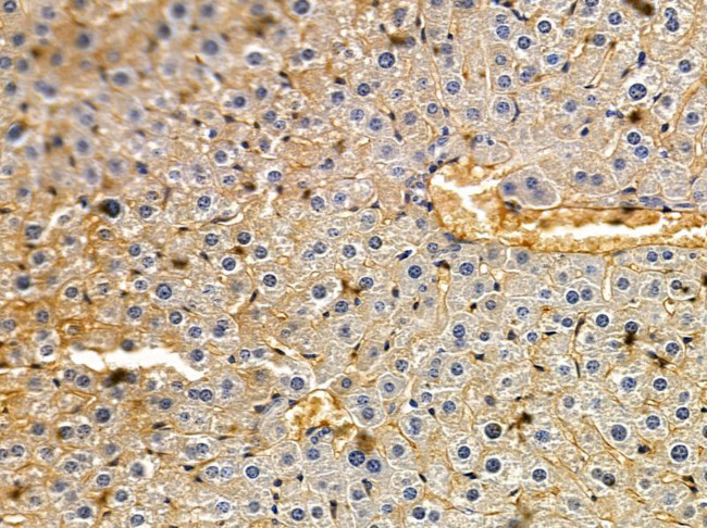 PLA1A Antibody in Immunohistochemistry (Paraffin) (IHC (P))