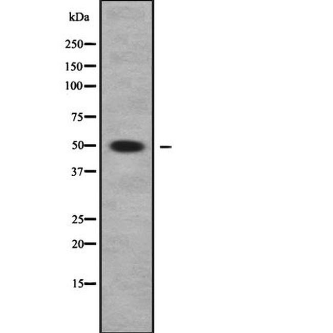 PLA1A Antibody in Western Blot (WB)