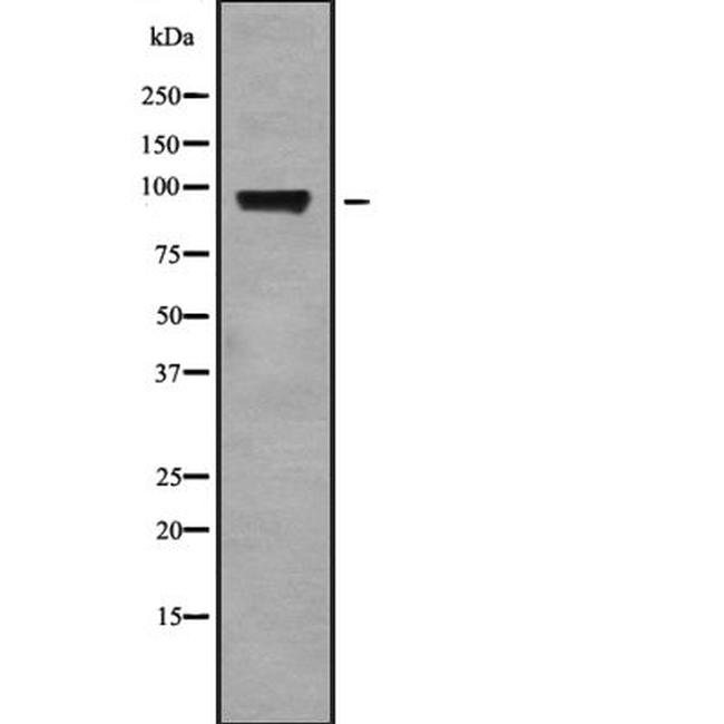 ELP2 Antibody in Western Blot (WB)