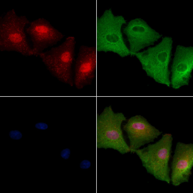 MAGEA12 Antibody in Immunocytochemistry (ICC/IF)