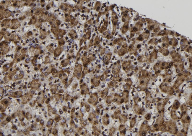 MAGEA12 Antibody in Immunohistochemistry (Paraffin) (IHC (P))