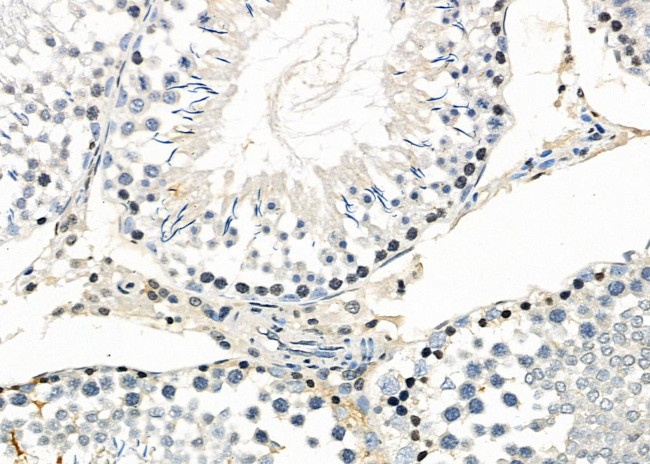 MAGEA12 Antibody in Immunohistochemistry (Paraffin) (IHC (P))