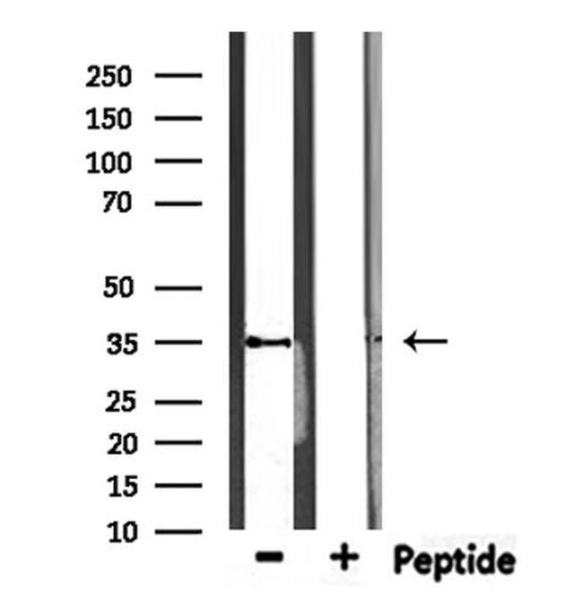 MAGEA12 Antibody in Western Blot (WB)