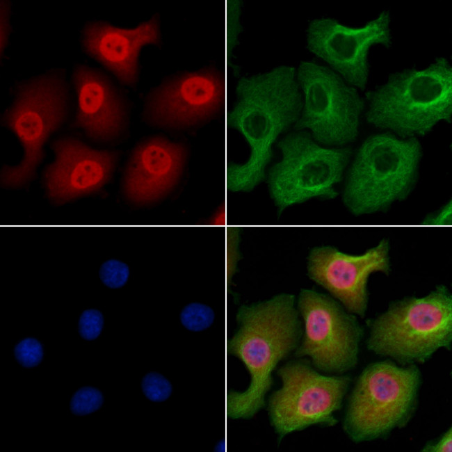 CDO1 Antibody in Immunocytochemistry (ICC/IF)