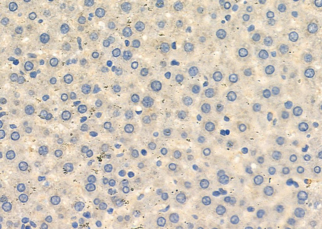 HTR3D Antibody in Immunohistochemistry (Paraffin) (IHC (P))