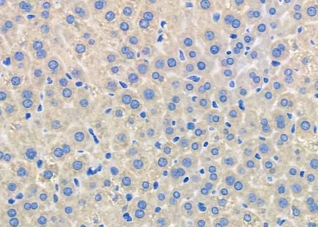 HTR3D Antibody in Immunohistochemistry (Paraffin) (IHC (P))