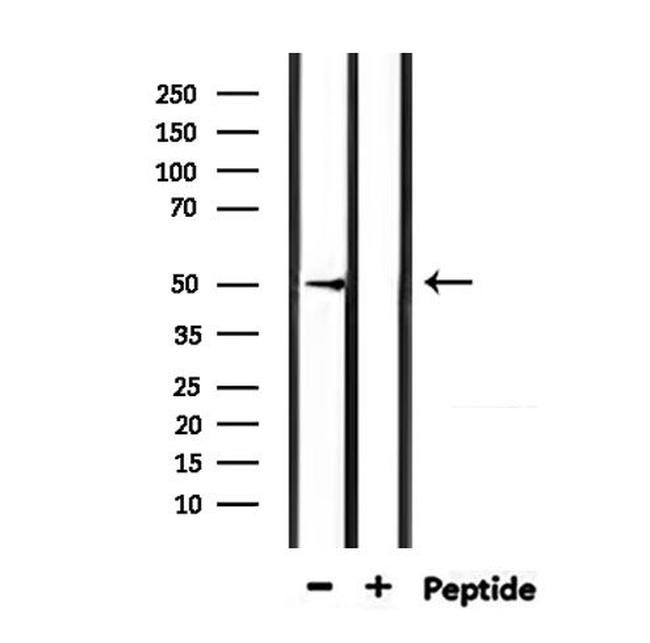 HTR3D Antibody in Western Blot (WB)