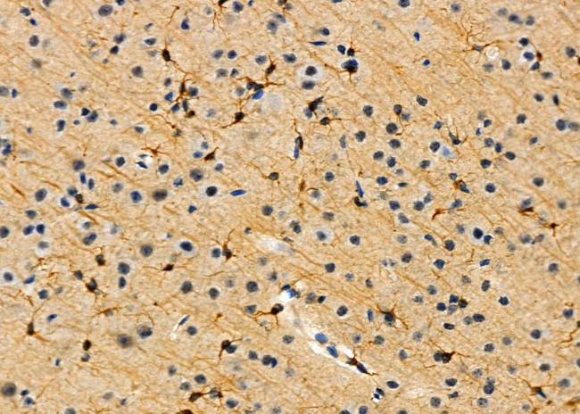 GLP2R Antibody in Immunohistochemistry (Paraffin) (IHC (P))