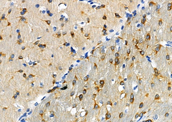 GLP2R Antibody in Immunohistochemistry (Paraffin) (IHC (P))