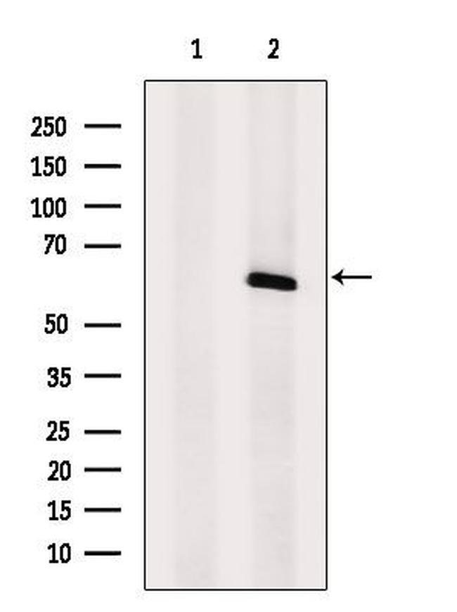 GLP2R Antibody in Western Blot (WB)