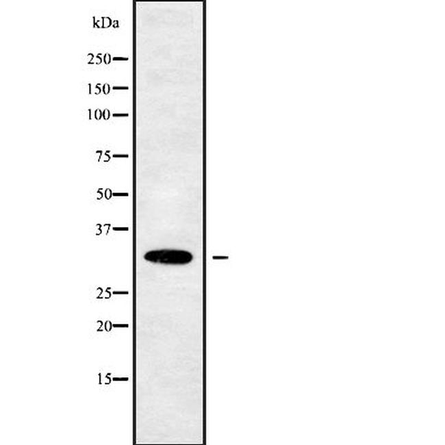 OR10W1 Antibody in Western Blot (WB)