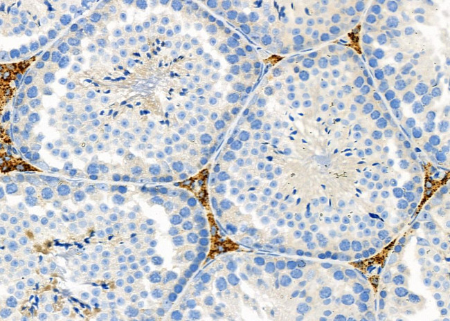 TAS2R50 Antibody in Immunohistochemistry (Paraffin) (IHC (P))