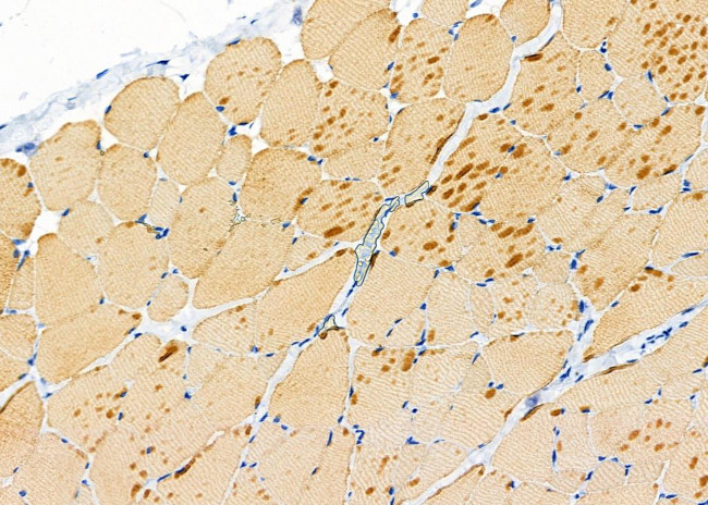 TAS2R50 Antibody in Immunohistochemistry (Paraffin) (IHC (P))