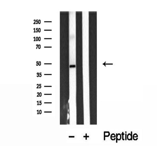 ARL13B Antibody in Western Blot (WB)