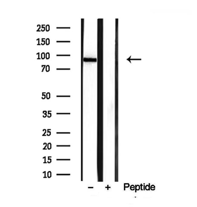 PLOD2 Antibody in Western Blot (WB)