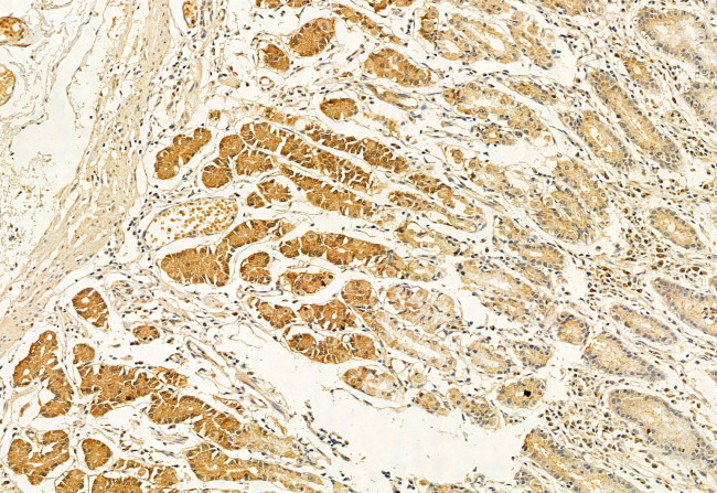 BBS5 Antibody in Immunohistochemistry (Paraffin) (IHC (P))