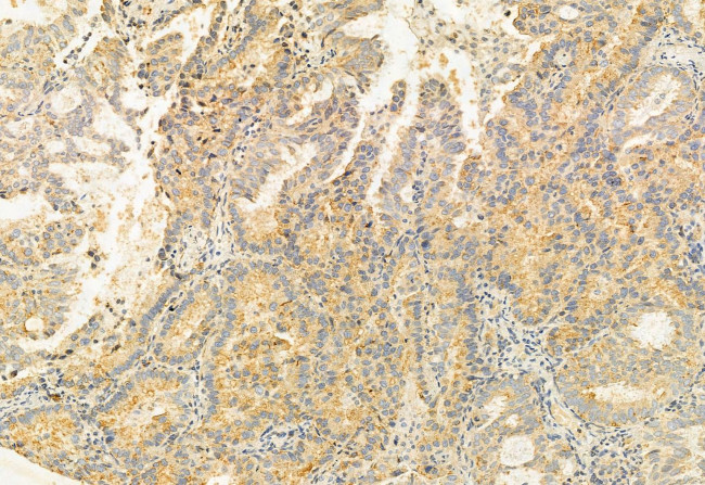 BBS5 Antibody in Immunohistochemistry (Paraffin) (IHC (P))