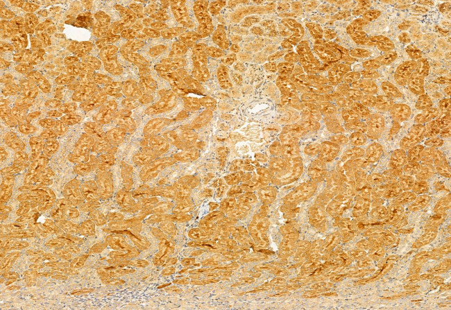 BBS5 Antibody in Immunohistochemistry (Paraffin) (IHC (P))