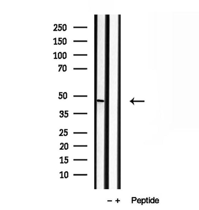 BBS5 Antibody in Western Blot (WB)