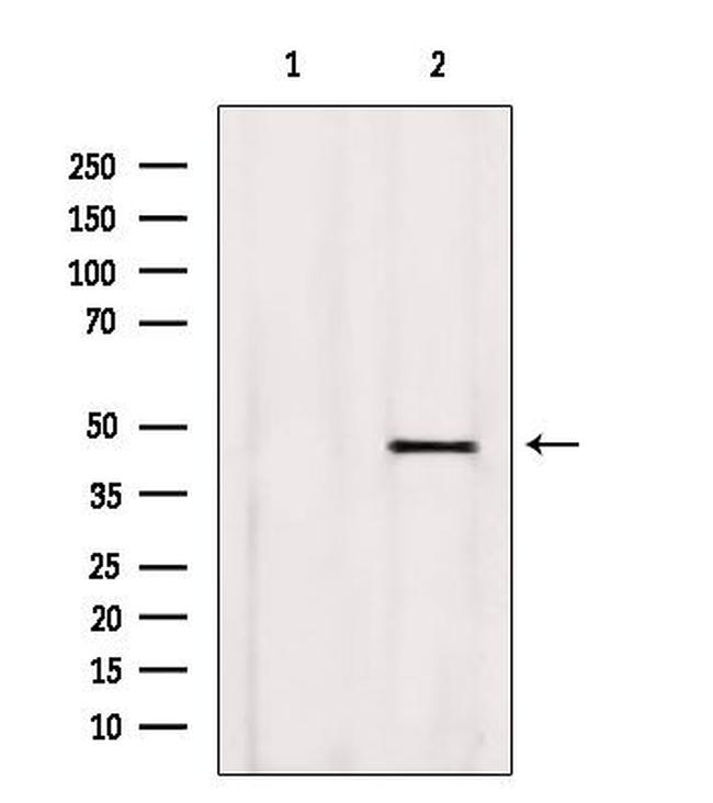 BBS5 Antibody in Western Blot (WB)