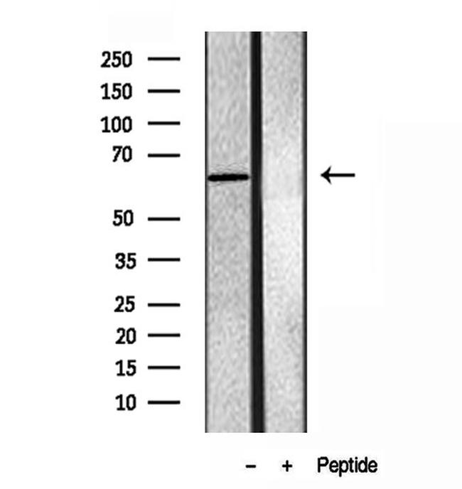 SQLE Antibody in Western Blot (WB)