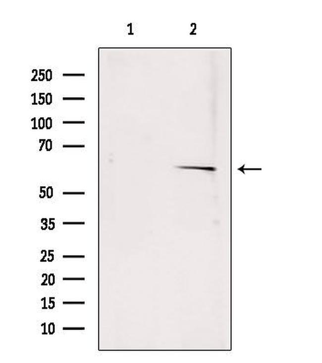 SQLE Antibody in Western Blot (WB)