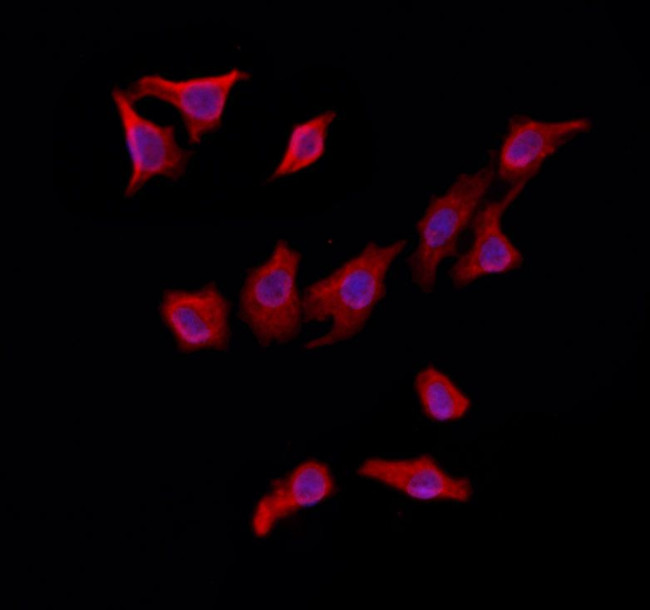 MAT2B Antibody in Immunocytochemistry (ICC/IF)