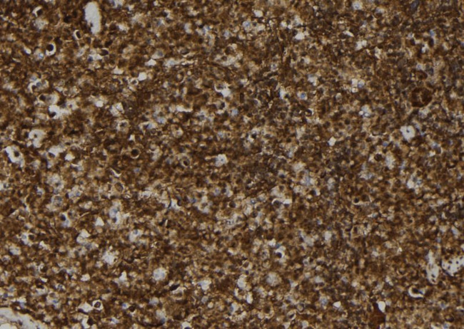 MAT2B Antibody in Immunohistochemistry (Paraffin) (IHC (P))