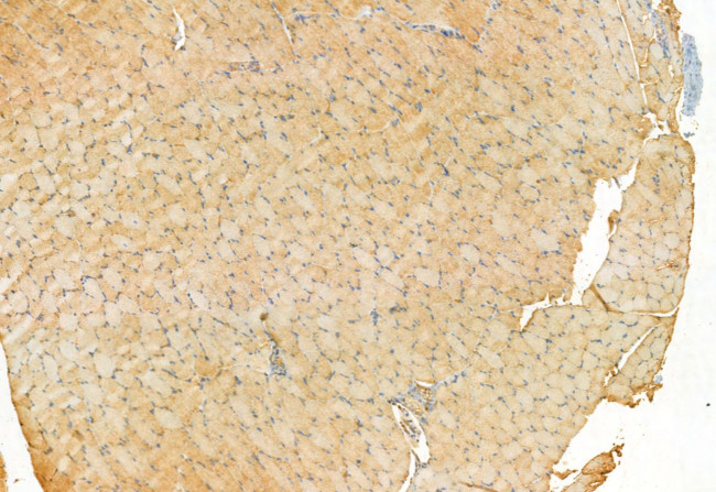 MAT2B Antibody in Immunohistochemistry (Paraffin) (IHC (P))