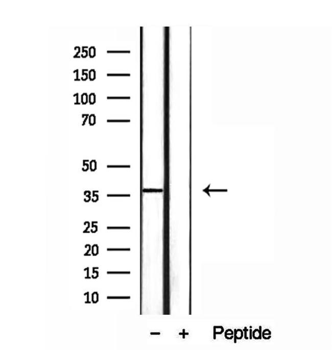 MAT2B Antibody in Western Blot (WB)