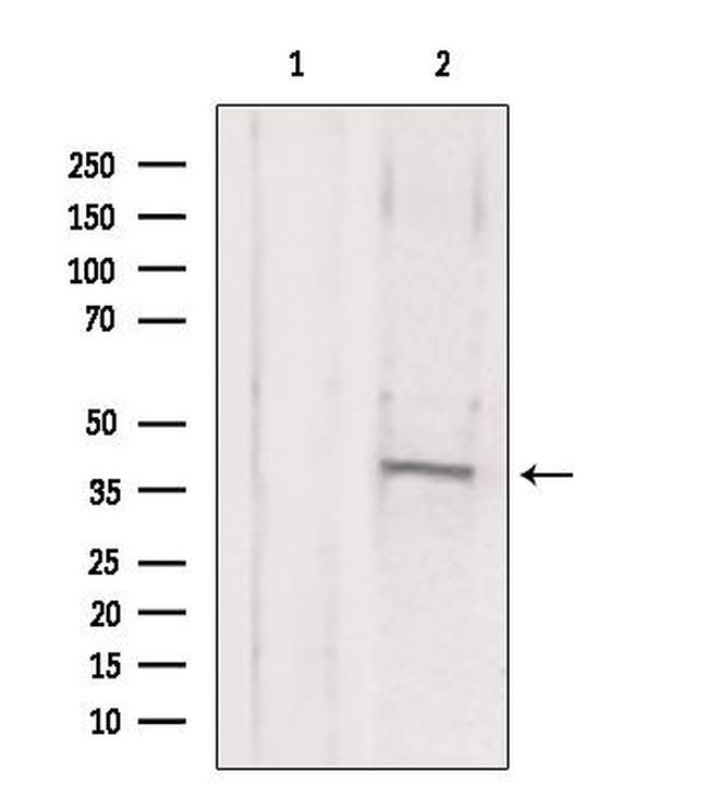 MAT2B Antibody in Western Blot (WB)