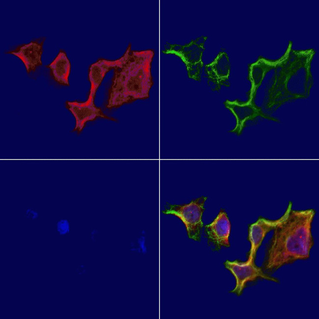 ATP Synthase beta Antibody in Immunocytochemistry (ICC/IF)