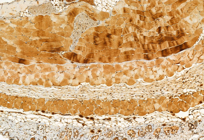 ATP Synthase beta Antibody in Immunohistochemistry (Paraffin) (IHC (P))