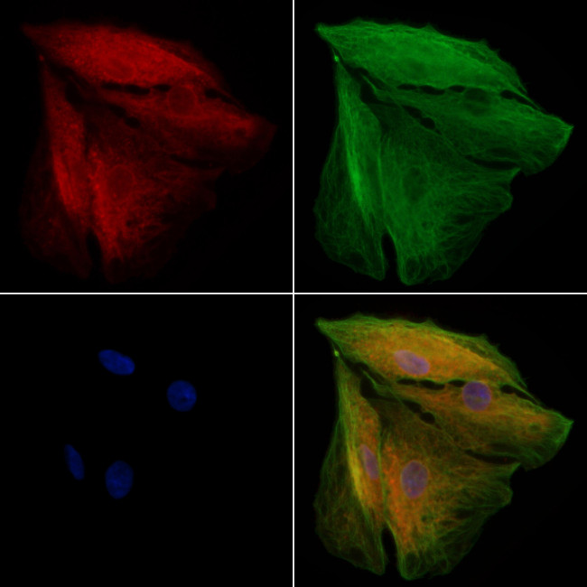 NOD2 Antibody in Immunocytochemistry (ICC/IF)