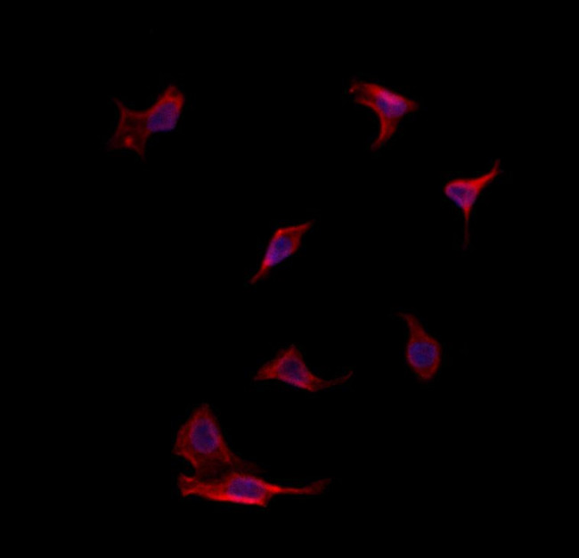 NOD2 Antibody in Immunocytochemistry (ICC/IF)