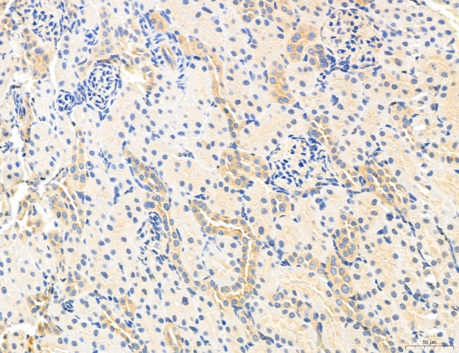 NOD2 Antibody in Immunohistochemistry (Paraffin) (IHC (P))