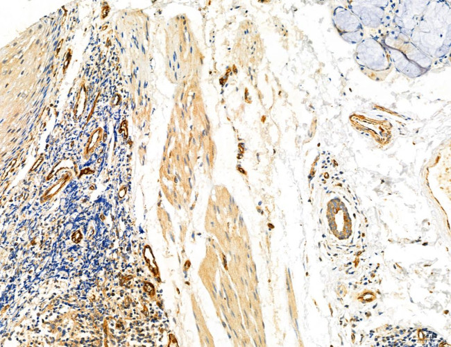 NOD2 Antibody in Immunohistochemistry (Paraffin) (IHC (P))