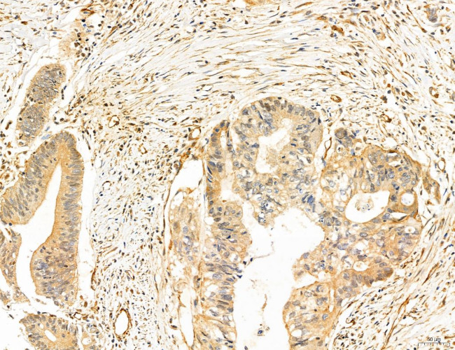 NOD2 Antibody in Immunohistochemistry (Paraffin) (IHC (P))