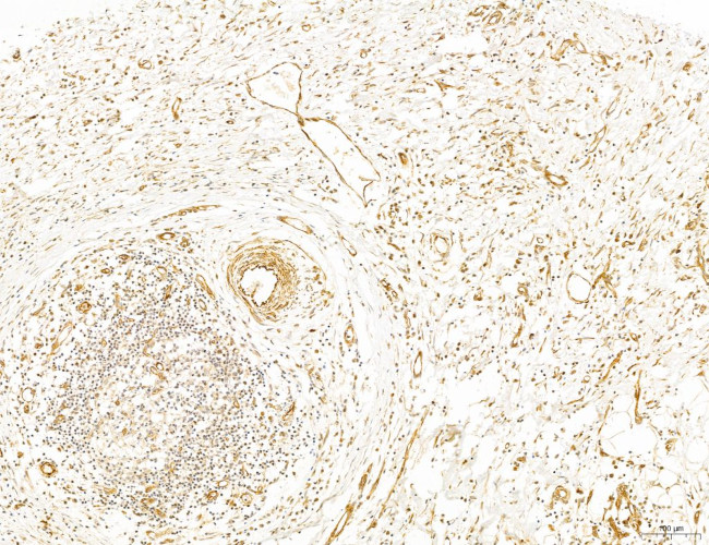 NOD2 Antibody in Immunohistochemistry (Paraffin) (IHC (P))