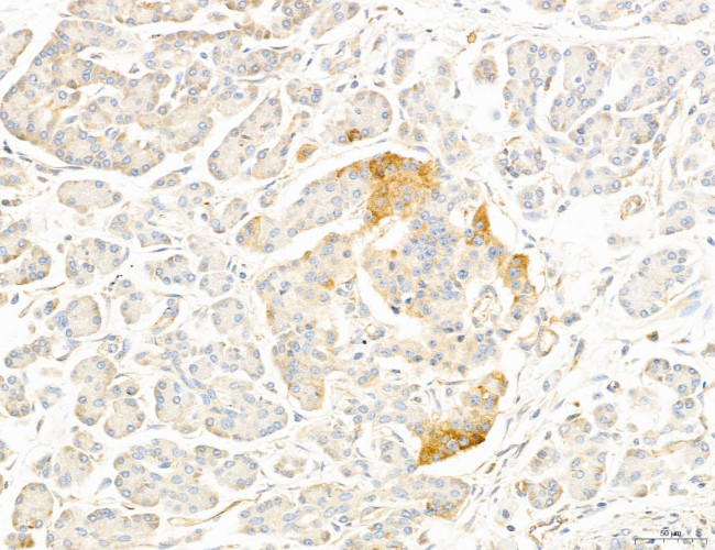 NOD2 Antibody in Immunohistochemistry (Paraffin) (IHC (P))