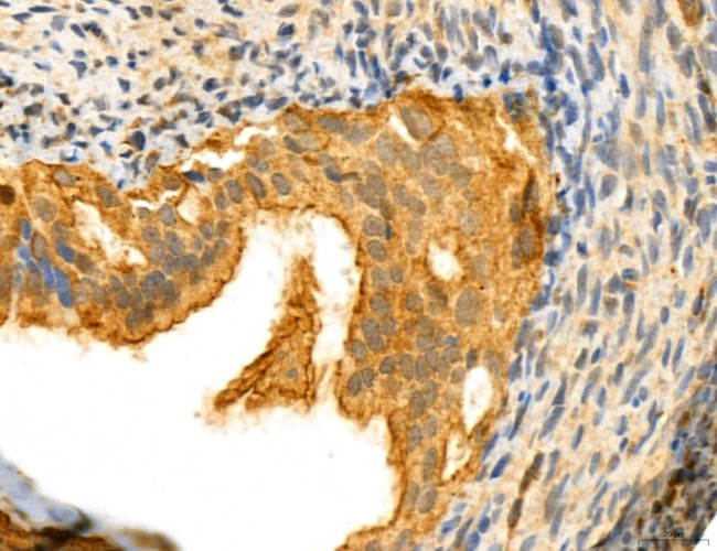 NOD2 Antibody in Immunohistochemistry (Paraffin) (IHC (P))